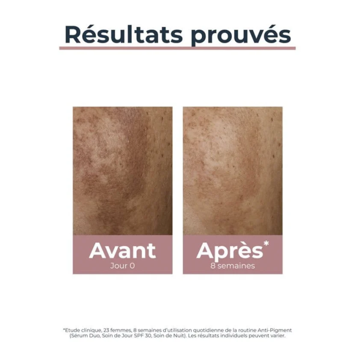 Anti Pigment Soin de Jour SPF 30 - EUCERIN