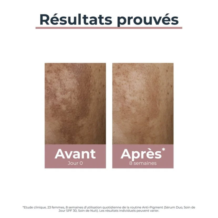 Offre Anti Pigment Serum Duo 30 ML + Sun Fluide Pigment Control 50 ML SPF 50+ Offert - EUCERIN