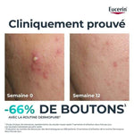 Offre Dermopure Serum Triple Action 40 ML + Oil Control 50ML Offert - EUCERIN