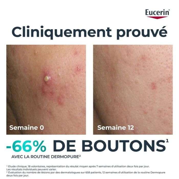 Offre Dermopure Serum Triple Action 40 ML + Oil Control 50ML Offert - EUCERIN
