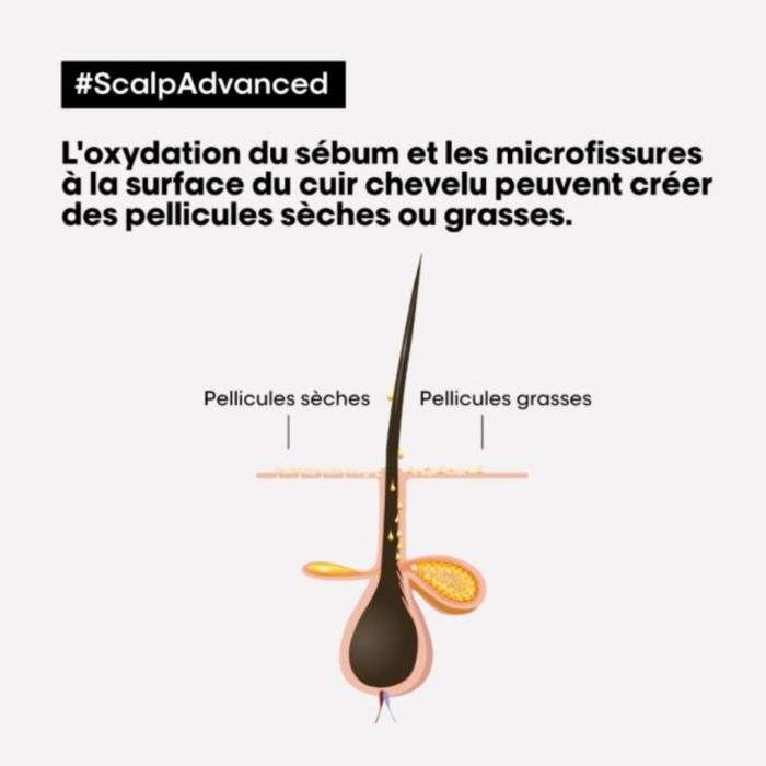 L'oreal Professionnel Scalp Advanced Shampooing Professionnel Dermo Clarifier 500 ML - L'OREAL PROFESSIONNEL PARIS