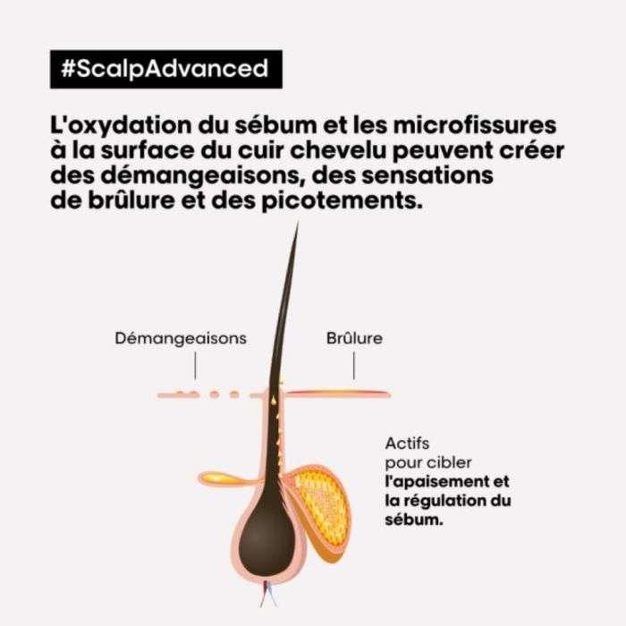 L’oreal Professionnel Scalp Advanced Shampooing Professionnel Dermo Regulateur 500 ML - L'OREAL PROFESSIONNEL PARIS