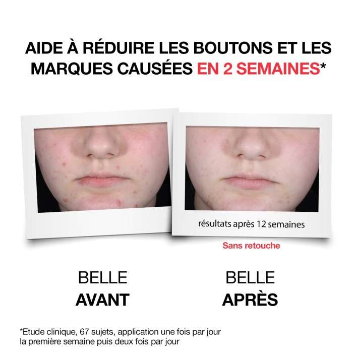 Anti Boutons+ Serum Quotidien 30ML - NEUTROGENA