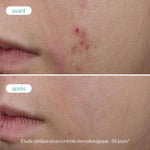 Serum Booster Trio Zinc Anti Imperfections Anti Age 30 ML - NOVEXPERT