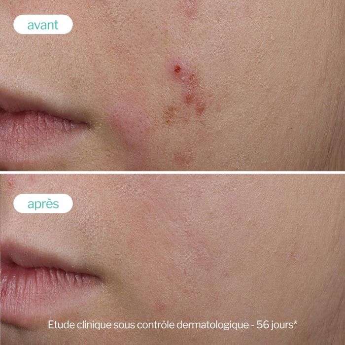 Serum Booster Trio Zinc Anti Imperfections Anti Age 30 ML - NOVEXPERT