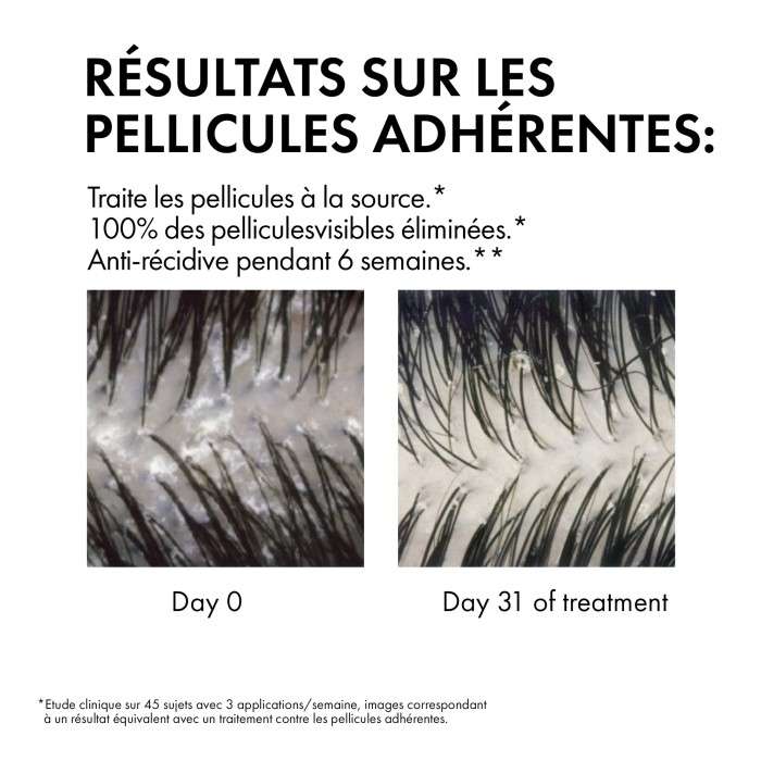 Vichy Dercos Offre Shampoing Anti Pelliculaire Ds Cheveux Secs 200 ML + un Format Voyage et une Serviette Dercos Offerts - DERCOS